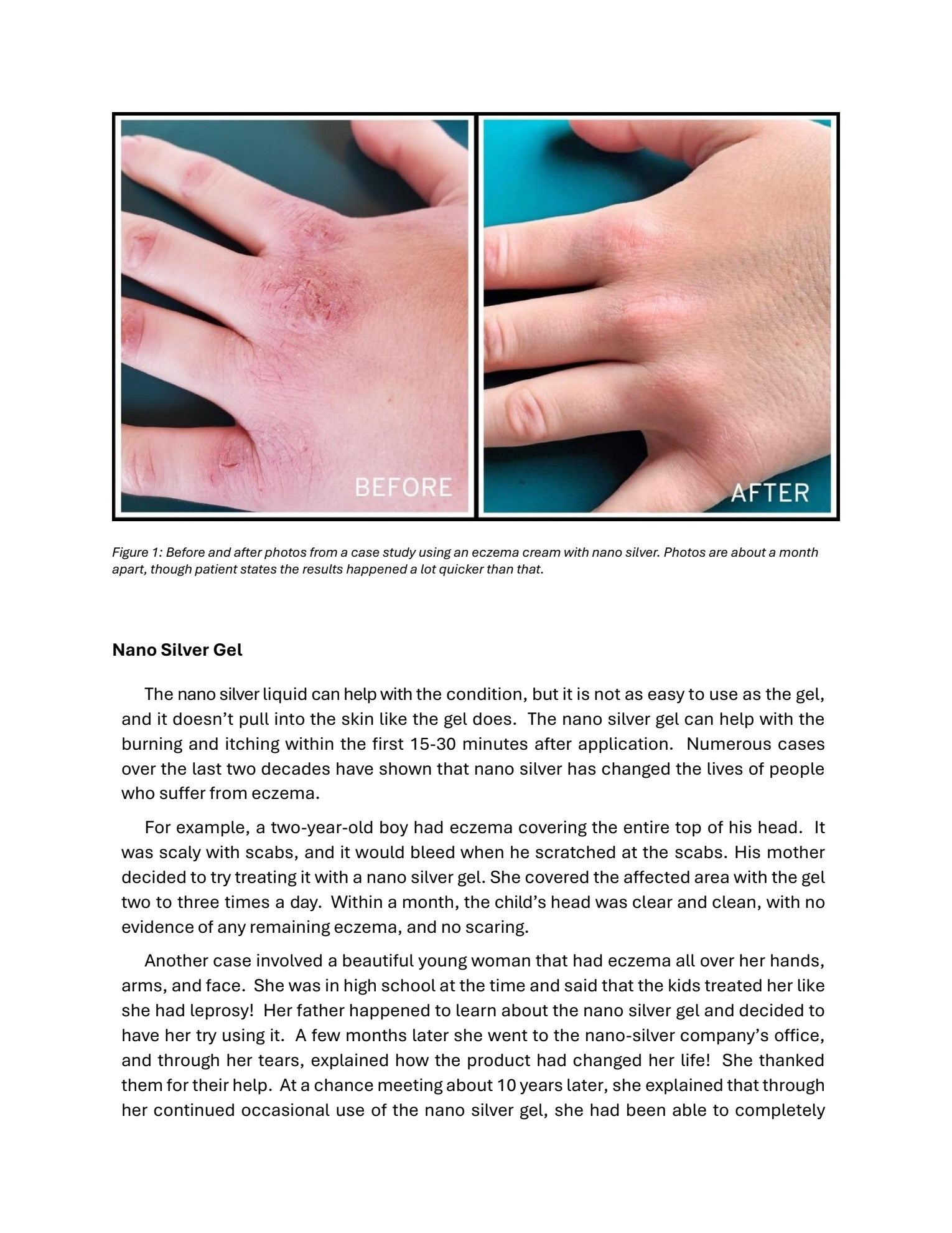 Eczema Therapy Report PDF page 4
