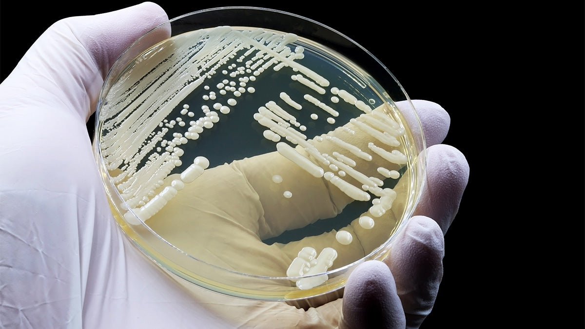 Candida auris culture in a petri dish