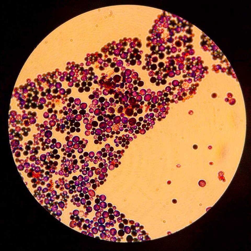 Candida cells under a microscope