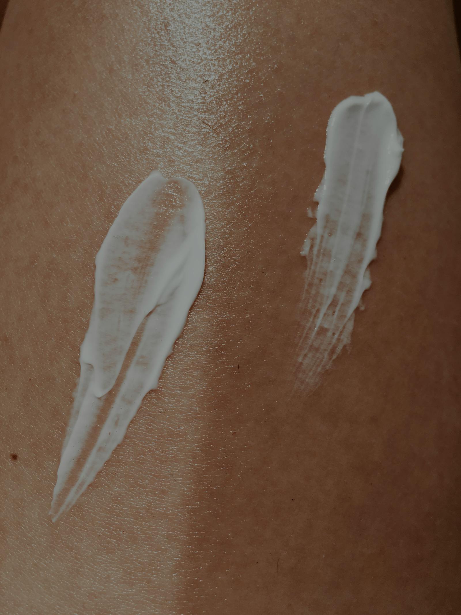 Skin cream application photo