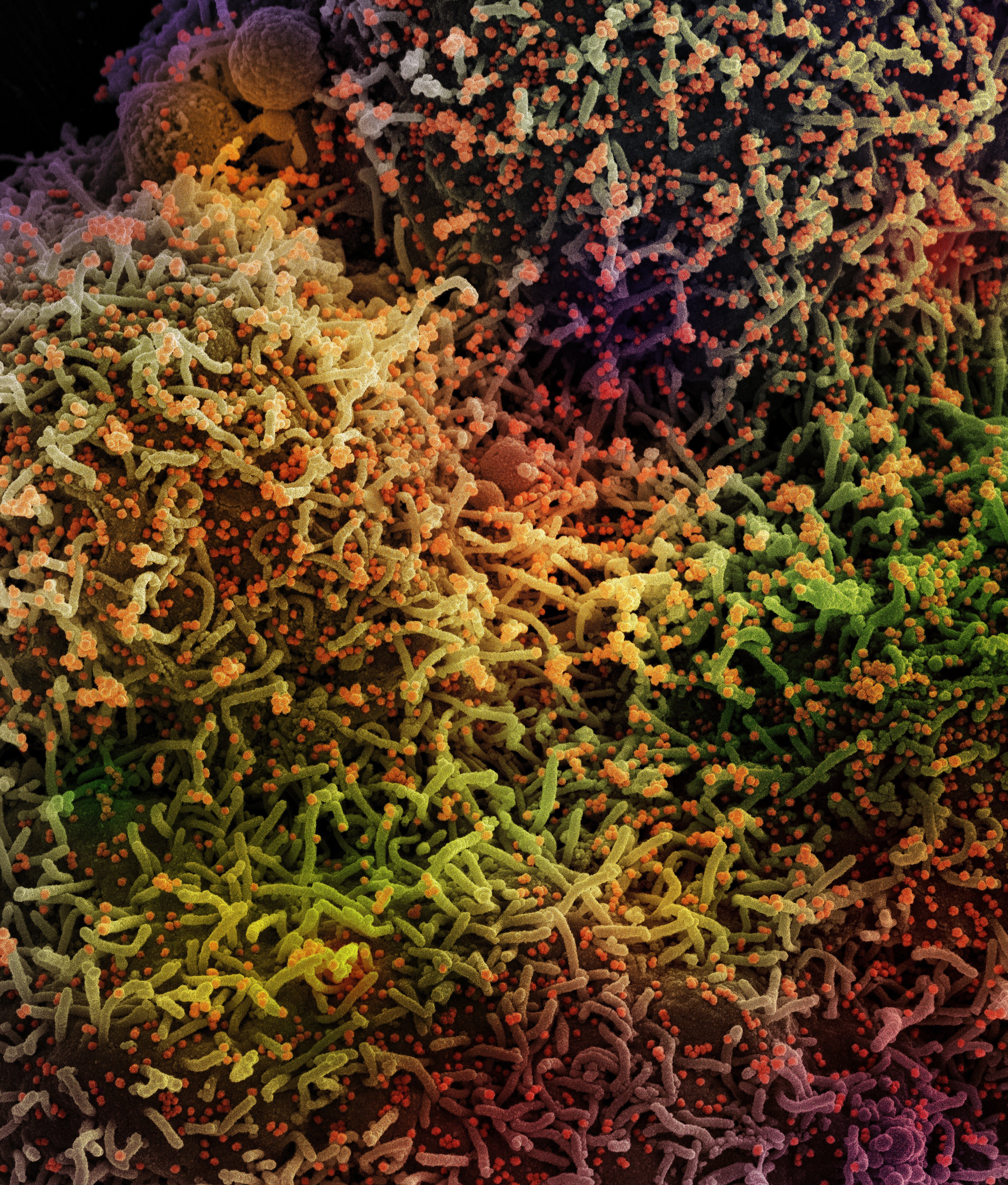 SARS-CoV-2 scanning electron micrograph