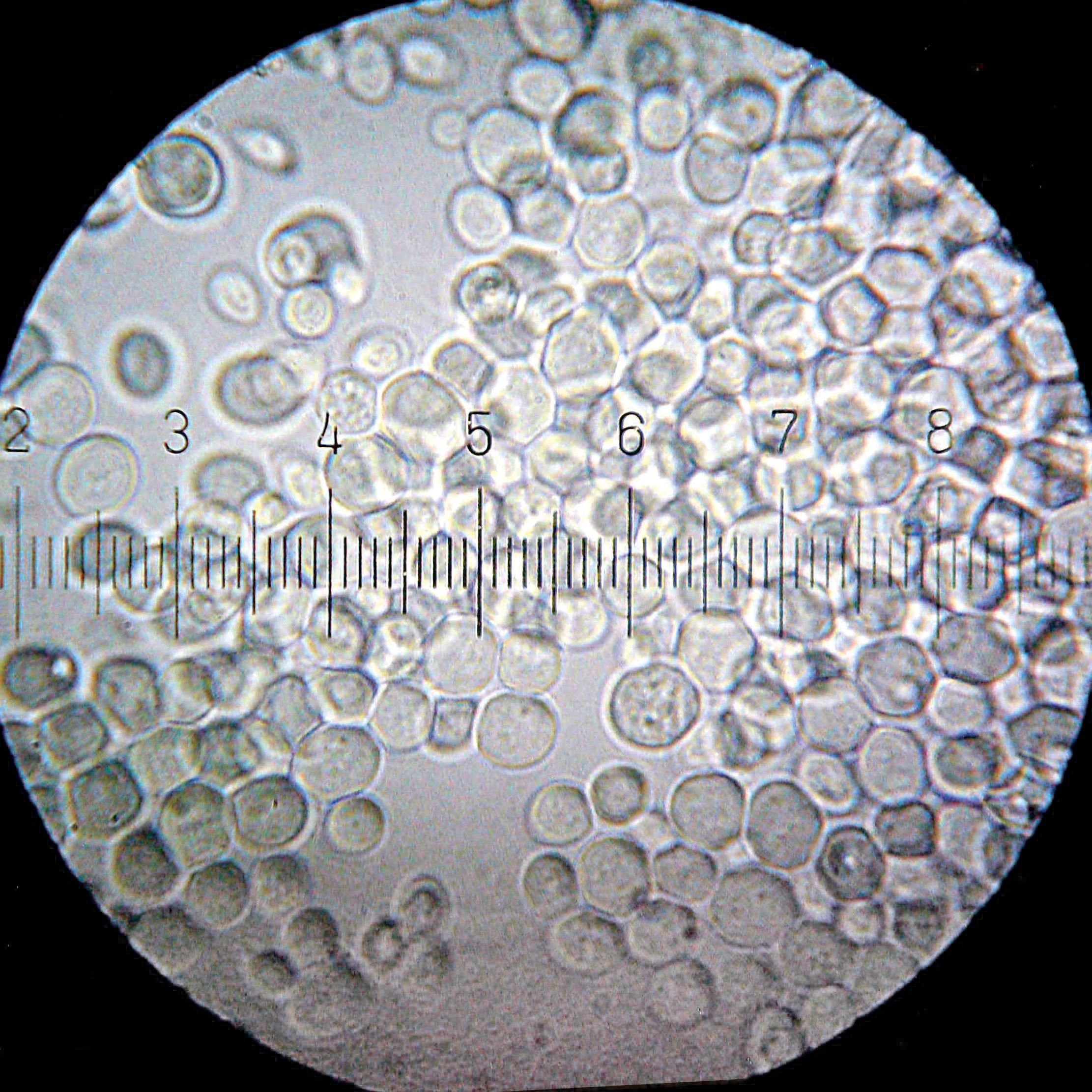 Yeast under microscope photo